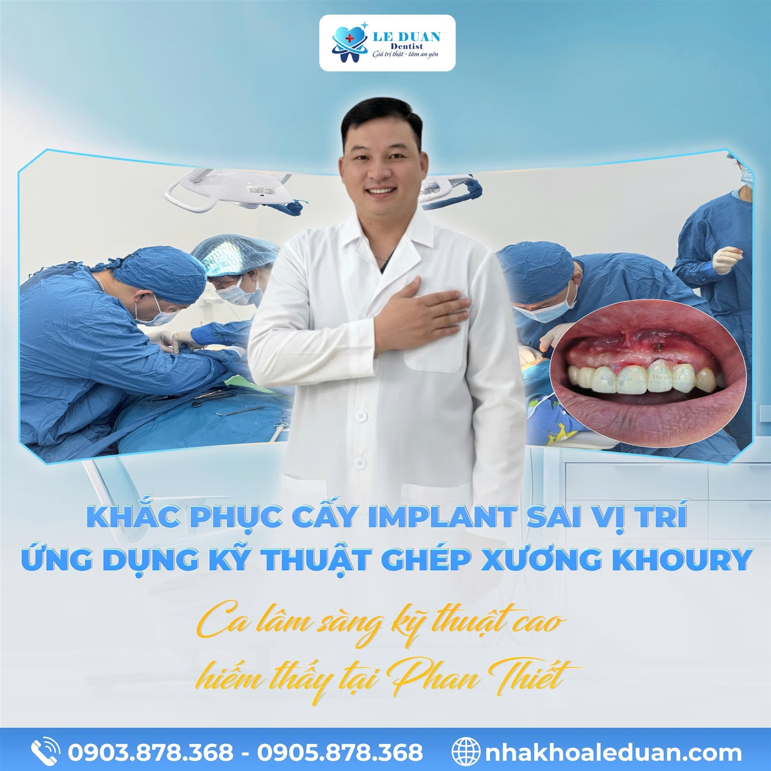 Ca lâm sàng kỹ thuật cao hiếm thấy tại Phan Thiết - Ứng dụng kỹ thuật ghép xương Khoury để khắc phục Implant sai vị trí 